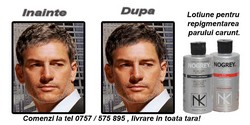 LOTIUNE REPIGMENTARE PAR CARUNT NOGREY CU KERATINA!